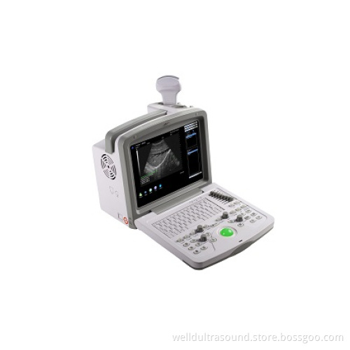 Full Digital Ultrasound Diagnostic System